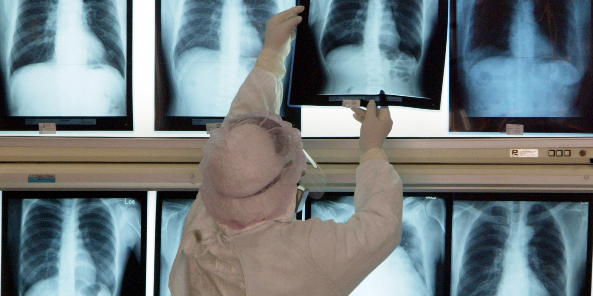 Yapay Zeka ve Radyoloji Üzerine