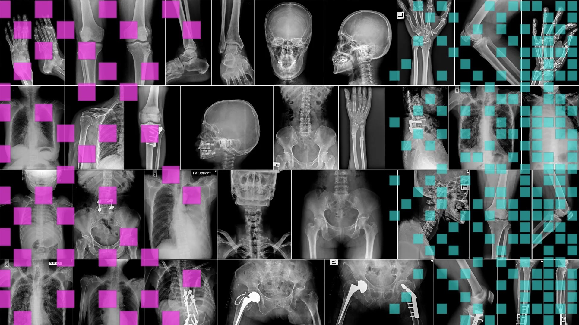 yapay zeka radyologlarin yerini aliyor mu TWkbYDUB